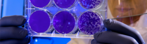 e coli bacteria