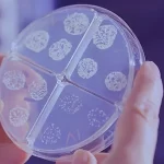 bacteria in water at microscope