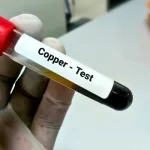 copper test