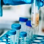 water testing samples in lab