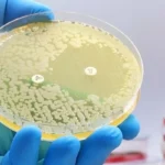 bacteria ready for microscope