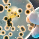 bacteria ready for microscope 6