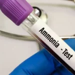 Ammonia in Drinking Water (9)