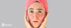 skin problems (1)