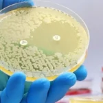 bacteria in tap water (2)