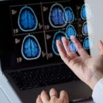 Brain scans on a laptop screen. Lead in drinking water health risks.