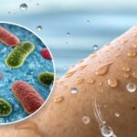 Skin rashes from water exposure. Bacteria on skin with water droplets. Water testing for skin irritation.