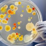 Coliform bacteria in a petri dish. Water testing for lead in older wells.