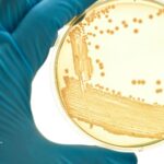Iron bacteria culture in petri dish. Testing for iron bacteria in well water.